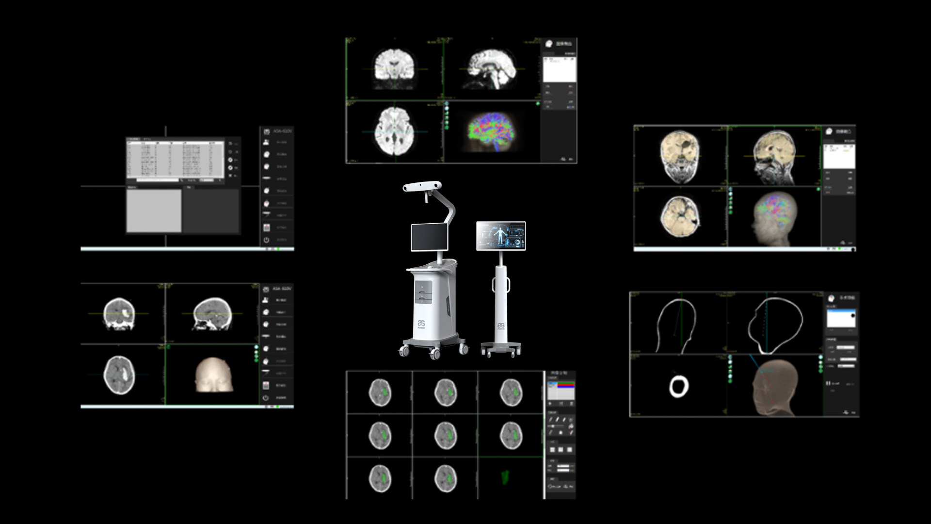 手术导航仪外观设计-安科手术导航仪外观设计